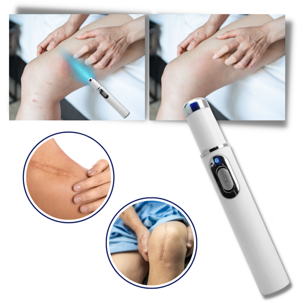 Tragbare Lasertherapie für einen strahlenden Teint 3