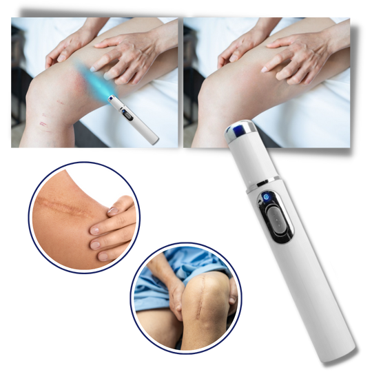 Tragbare Lasertherapie für einen strahlenden Teint 3