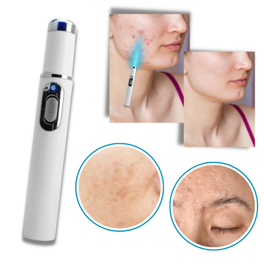 Tragbare Lasertherapie für einen strahlenden Teint 4