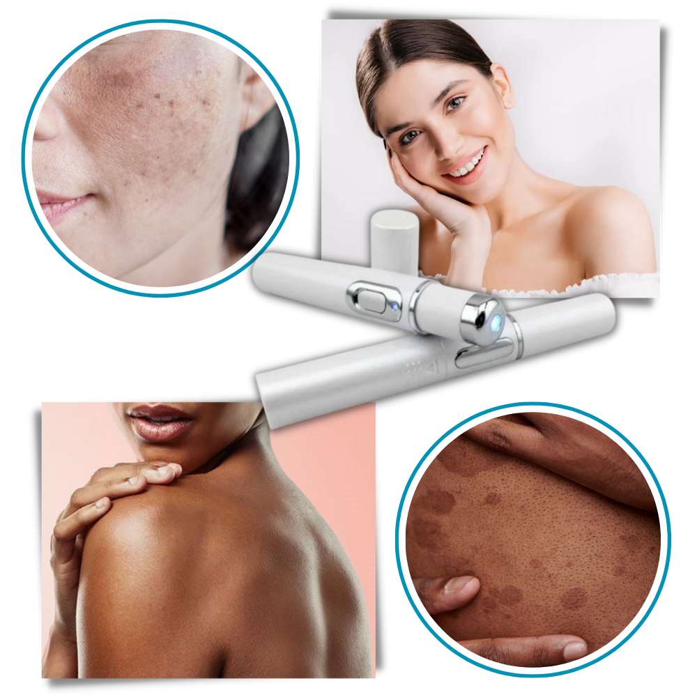 Tragbare Lasertherapie für einen strahlenden Teint 5