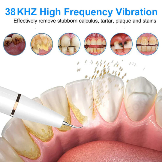 Ultraschall Zahnbürste SonicClean 2