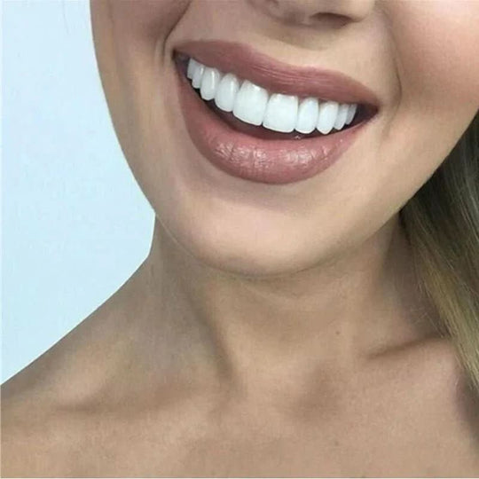 Zahnveneers für ein strahlendes Lächeln 2