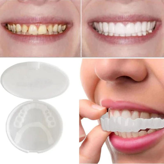 Zahnveneers für ein strahlendes Lächeln 3